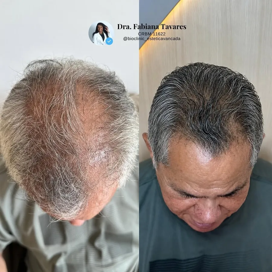 Couro cabeludo antes e depois do tratamento capilar